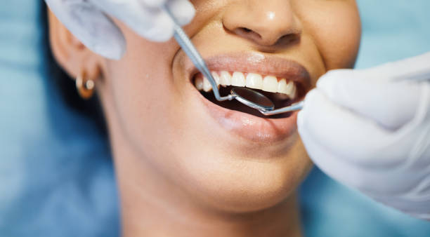 Best Cracked Tooth Emergency Dentist  in Lookout Mountain, TN