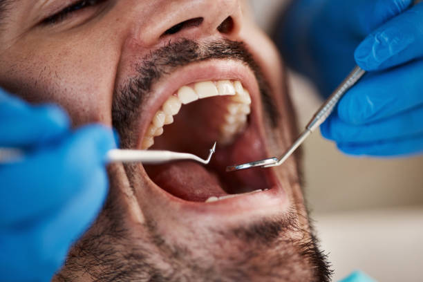 Best Chipped Tooth Repair Near Me  in Lookout Mountain, TN
